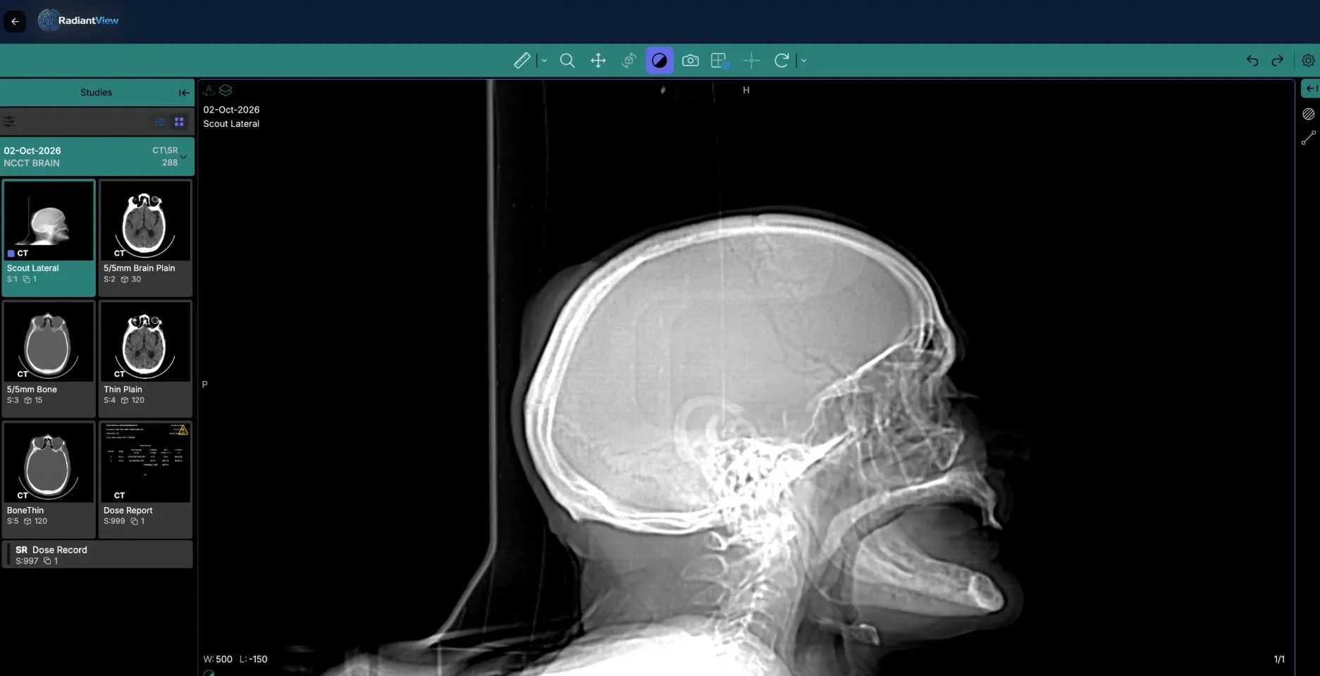 The RadiantView DICOM viewer showing a CT brain study